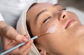 Chemical Peels