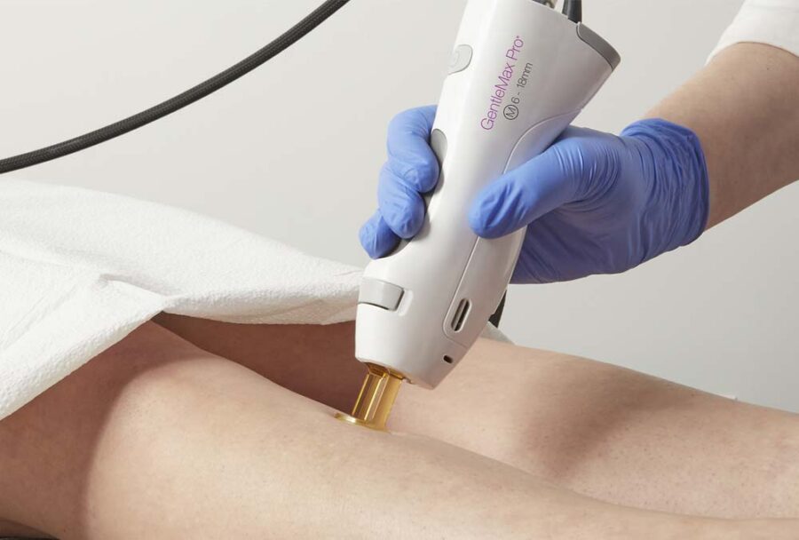 Everything You Need to Know Before Your First Laser Hair Removal Session